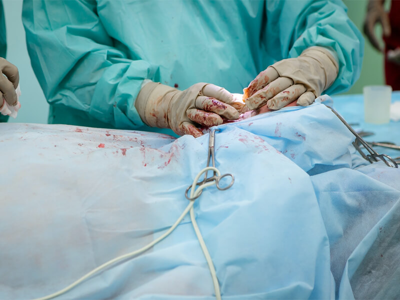 img-Gallbladder-Surgery