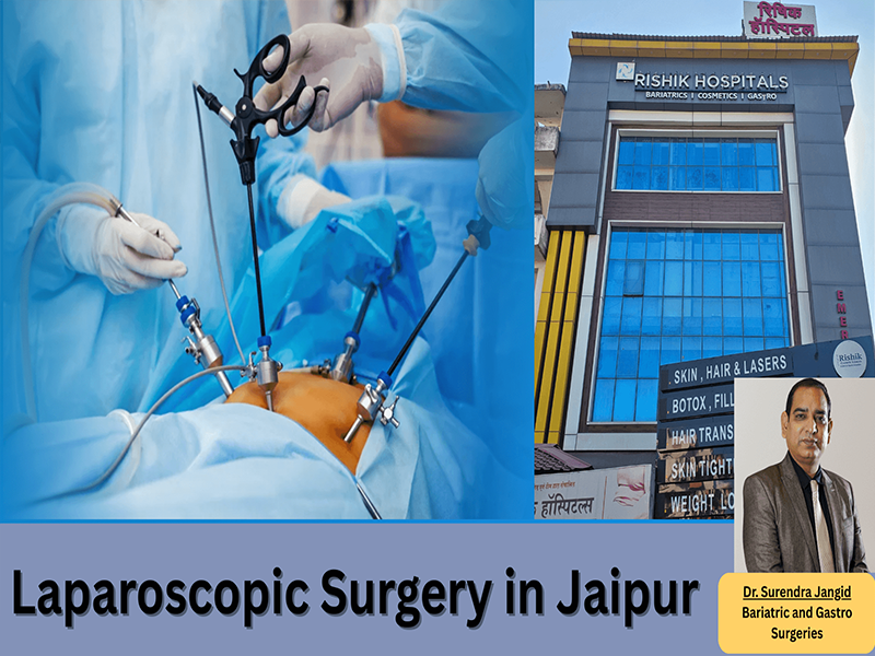 laparoscopic